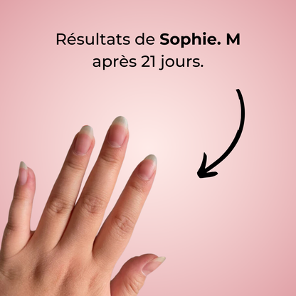 alluma. | Sérum Réparateur et de Croissance des Ongles (1 Acheté = 1 OFFERT)