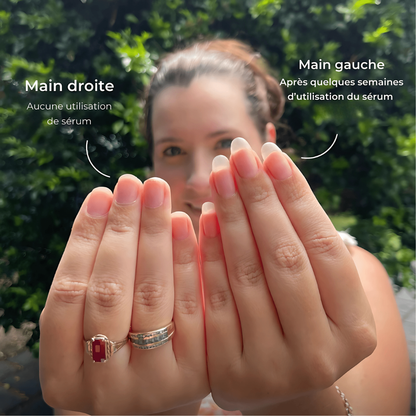 alluma. | Sérum Réparateur et de Croissance des Ongles (1 Acheté = 1 OFFERT)